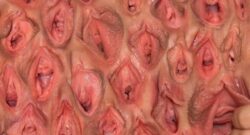 Pared Vaginal
