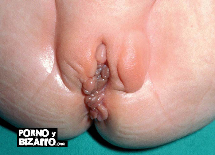 Glándulas anales gato infectadas